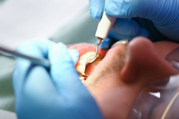 Best Emergency Treatment for Dental Infections or Abscesses in Garden City, NY